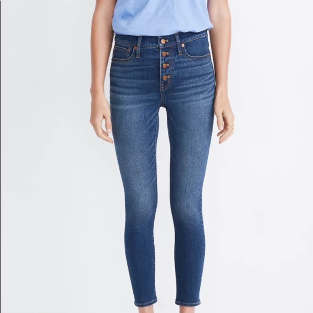 9” skinny crop Madewell button front jeans